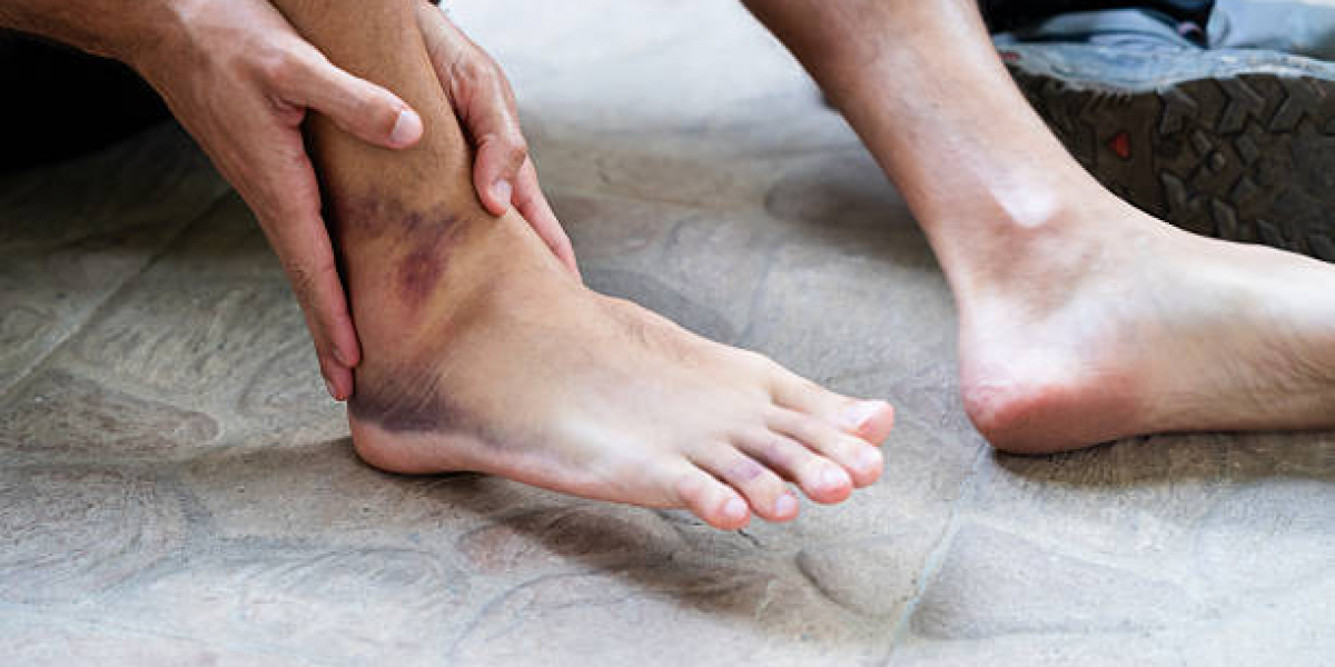 How Sports Podiatrists Treat Ankle Sprains for Faster Recovery